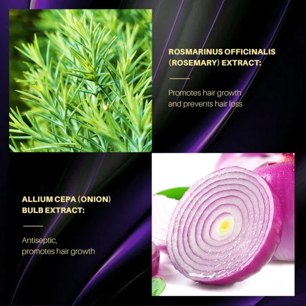 Hair Shampoo For Fast Hair Growth Rosemary Onion Hair Regrowth Shampoo Anti Hair Loss Effective Within 7 Day Hair Care Product - Image 6